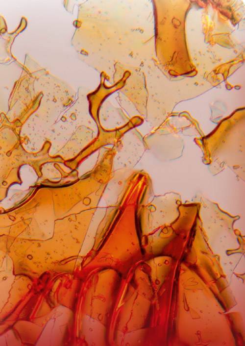Hämoglobin-Kristalle unter dem Mikroskop