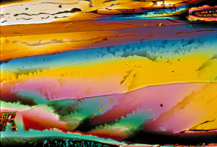 Cholin-Kristalle unter dem Mikroskop